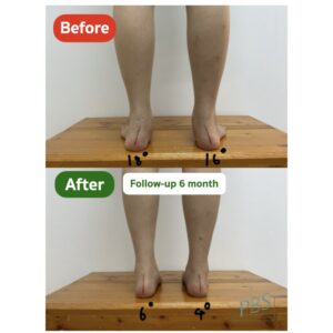 ปกคลิป Tiktok.001